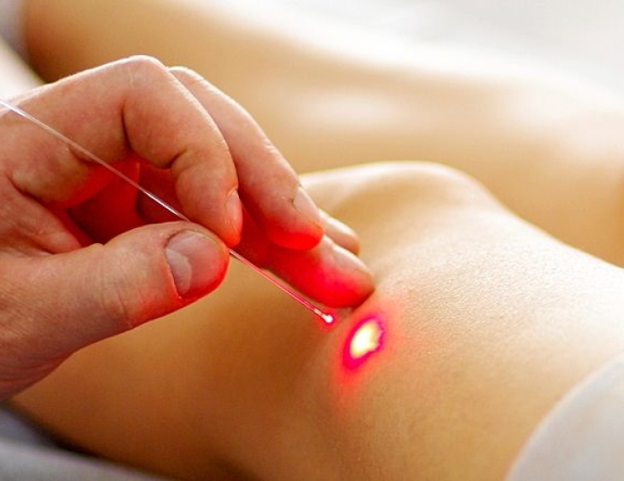 Лазеротерапия - Оздоровительные услуги - Санаторий «Ченки»